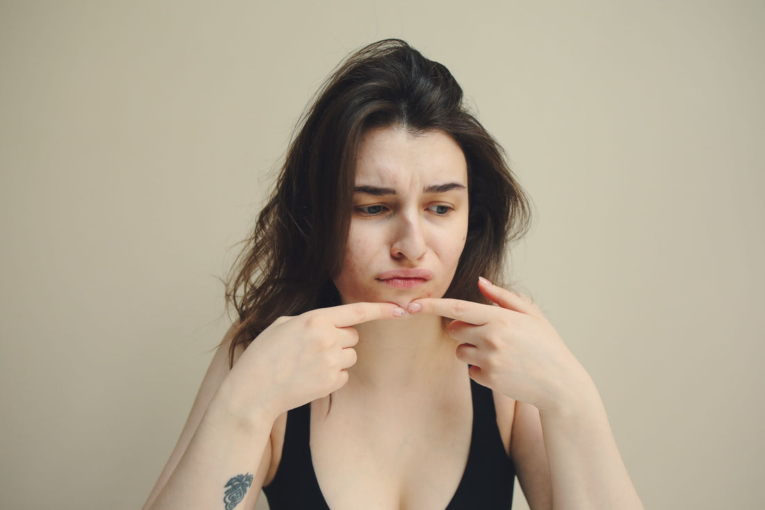 Acné et hygiène de vie : ce qui fonctionne vraiment (et ce qui relève du mythe)